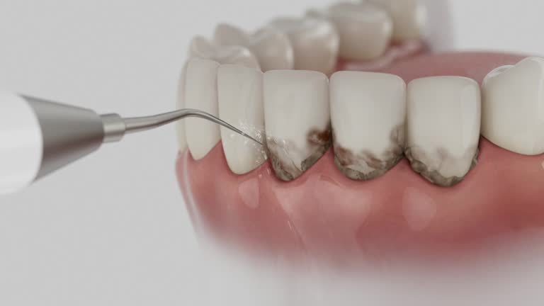 Reliable Dental Crowns And Bridges contractor in LaSalle Parish County, LA by Dentist Open Now